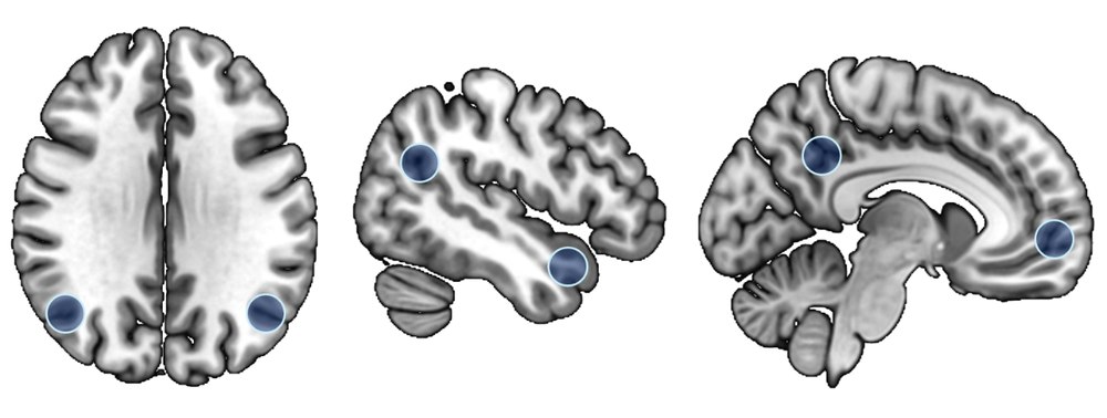 Brain image of the self-referential network
